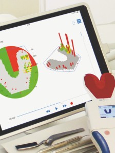 A hand-held reader can dynamically record masticatory pressure distribution thanks to innovative printed sensors.